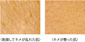 乾燥してキメが乱れた肌とキメが整った肌